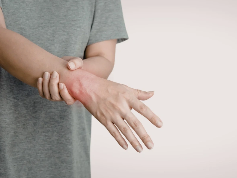 Image of a person experiencing inflammation.